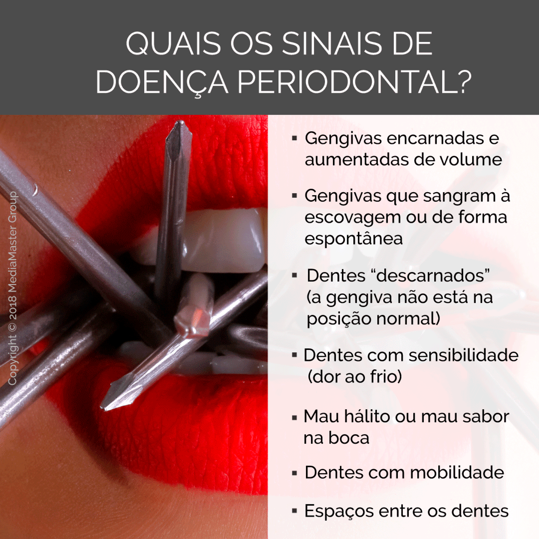 https://domainsforweb.com//public/uploads/Clientes_SocialMedia/CCDO/doenca-periodontal.png
